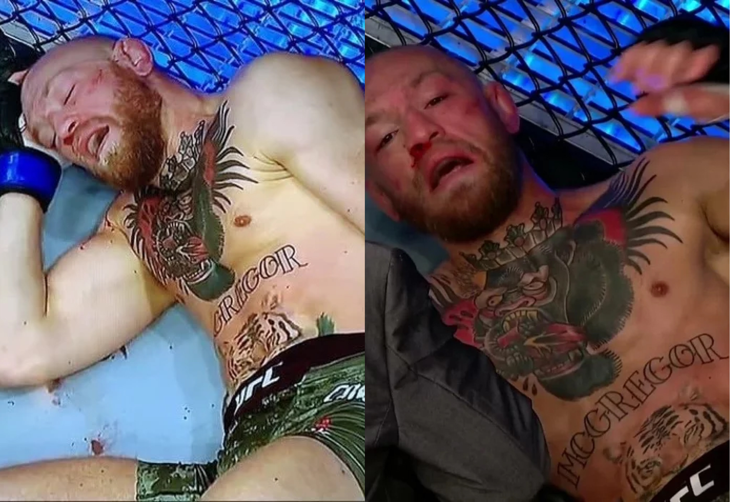 Conor Mcgregor Porn