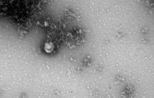 Появилось первое фото "британского" коронавируса-мутанта