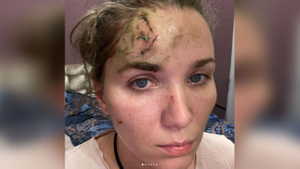 Бывшая жена актёра Епифанцева показала травмы после драки в петербургском ресторане