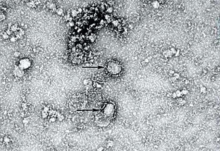 Коронавирус. Фото © The Chinese disease prevention authority