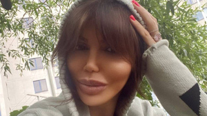 Экс-жена Аршавина выложила пугающие фото, показав вблизи изуродованное болезнью лицо