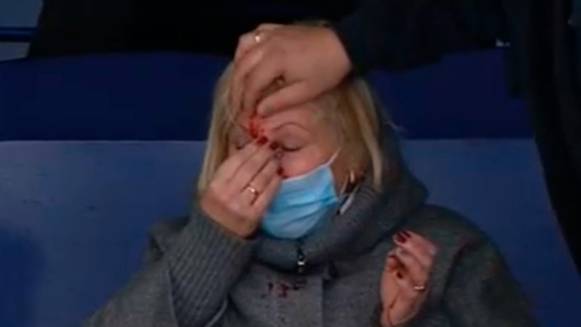 Шайба разбила лицо болельщице на матче "Ак Барс" — "Динамо". Фото © Спорт 24