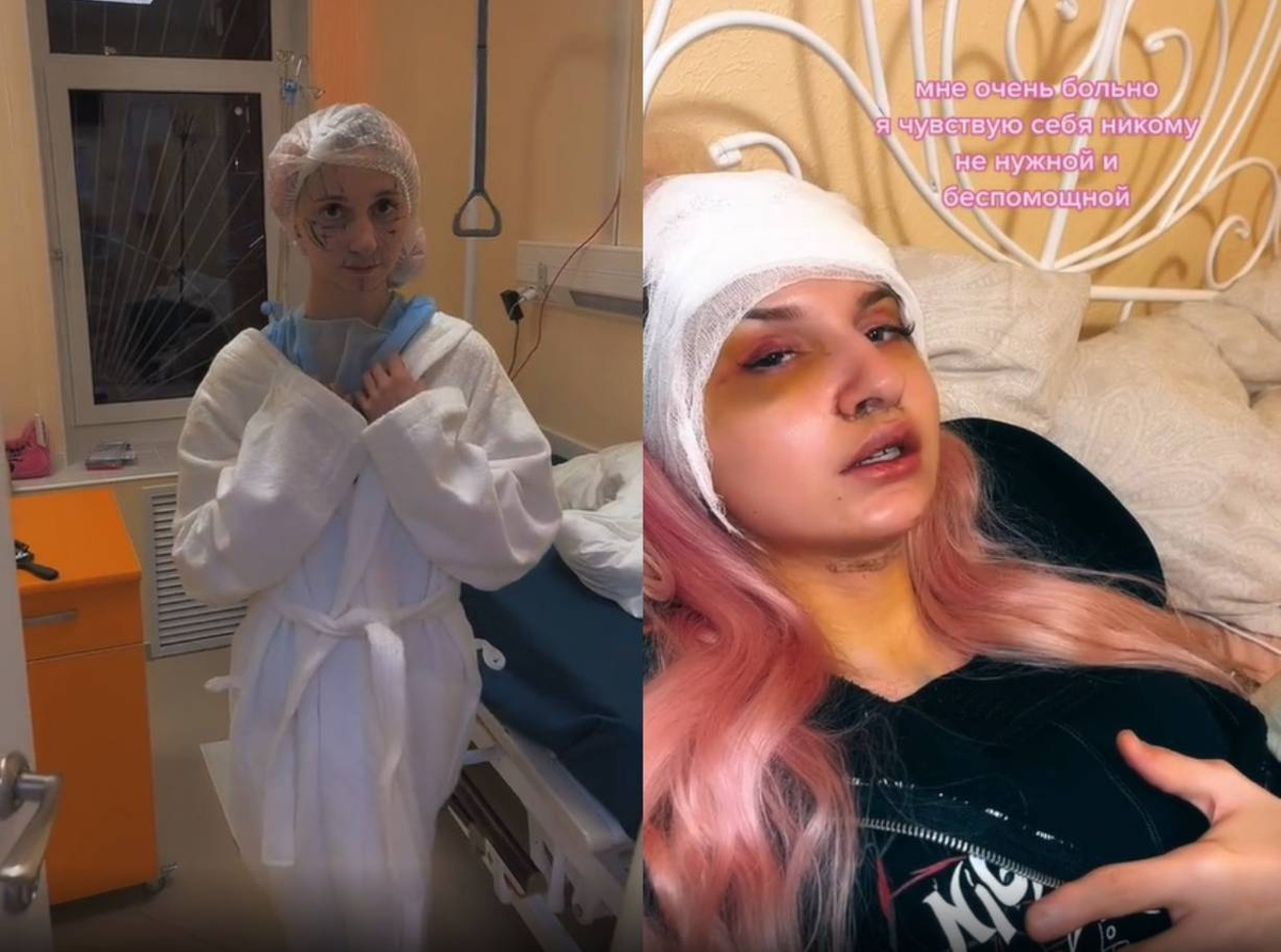 У сменившей пол блогерши Даши Корейки перекосило лицо после операции