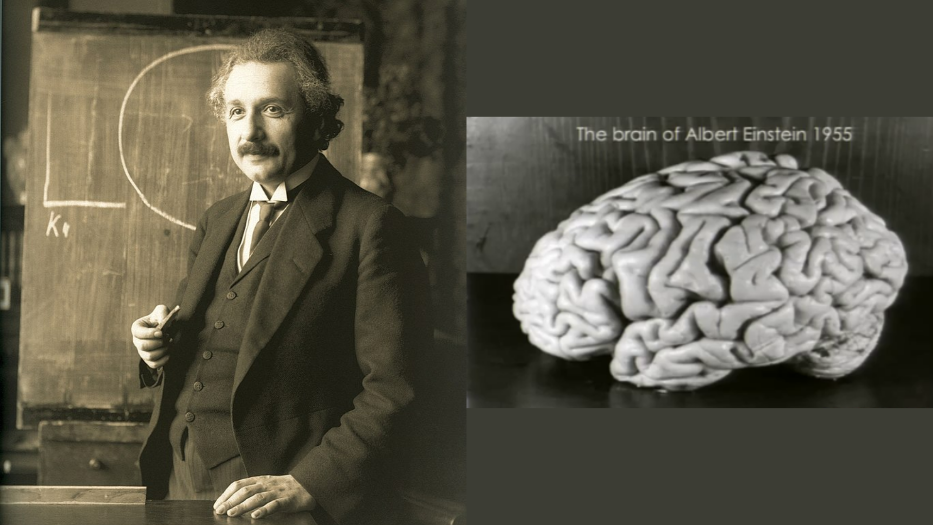 Эйнштейн и его мозг. Фото © Wikimedia Commons / bhm.ch, T. Harvey