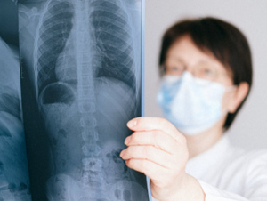 Онколог Давыдов рассказал, какие симптомы рака лёгких путают с коронавирусом