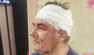 В Геленджике мужчина избил беременную жену и ветерана МВД на глазах у маленькой дочери
