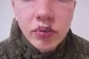Наказал за ругань: В Чебаркуле срочник зашил себе рот после ссоры с девушкой