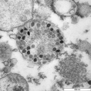 Штамм коронавируса "омикрон" © Роспотребнадзор
