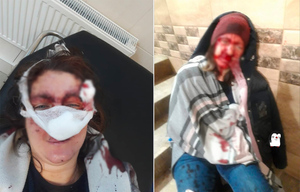 В Петербурге неизвестный зверски избил женщину на улице и похитил её маленького сына