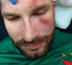 Дикая драка в Лиге Европы: футболиста "Славии" обвинили в расизме и избили после матча