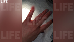 В Уссурийске таксист откусил палец женщине, сфотографировавшей его машину