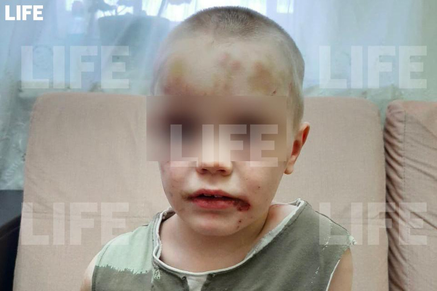 Избитый мальчик, найденный в квартире в Новороссийске. Обложка © LIFE