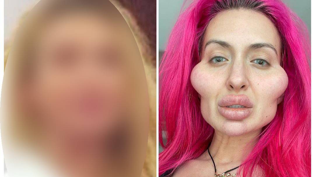 Блогерша из Киева с самыми большими скулами показала себя 3 года назад, и разница расстроит любого
