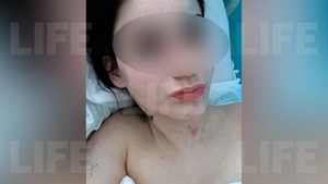"Хотела выйти из бизнеса": Выпрыгнувшая в Барнауле из окна девушка спасалась от сутенёрши