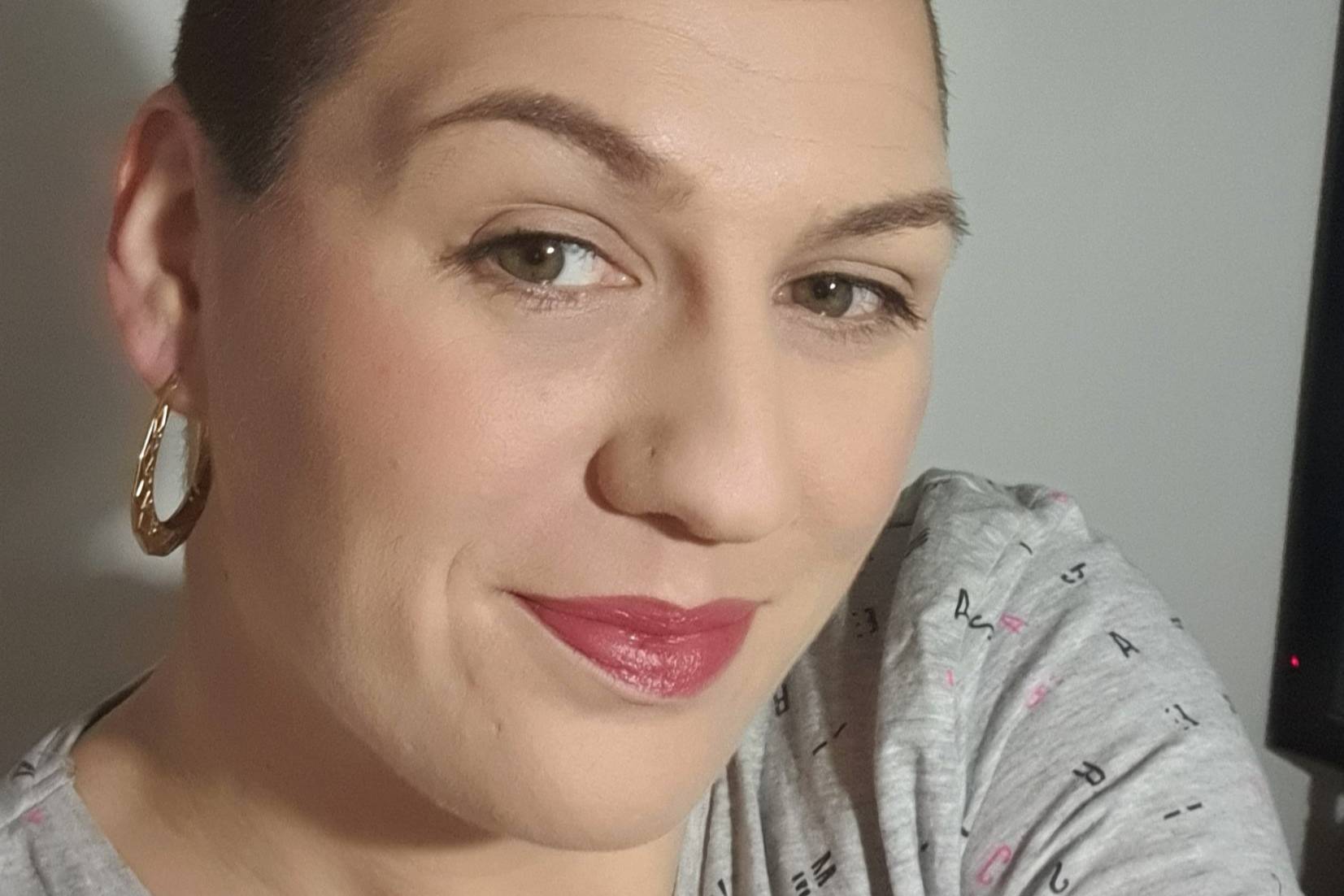 Девушка оказалась в инвалидном кресле из-за вакцины от CoViD, после которой её ноги покрылись язвами