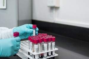 Центр Гамалеи намерен подать документы для испытания новых платформ для вакцин от ковида