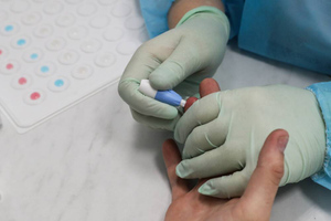 Швейцарские учёные изобрели тест, определяющий наличие антител к ковиду по капле крови
