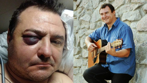 Экс-солисту группы "Лесоповал" сломали челюсть и разбили голову во время драки в Сочи