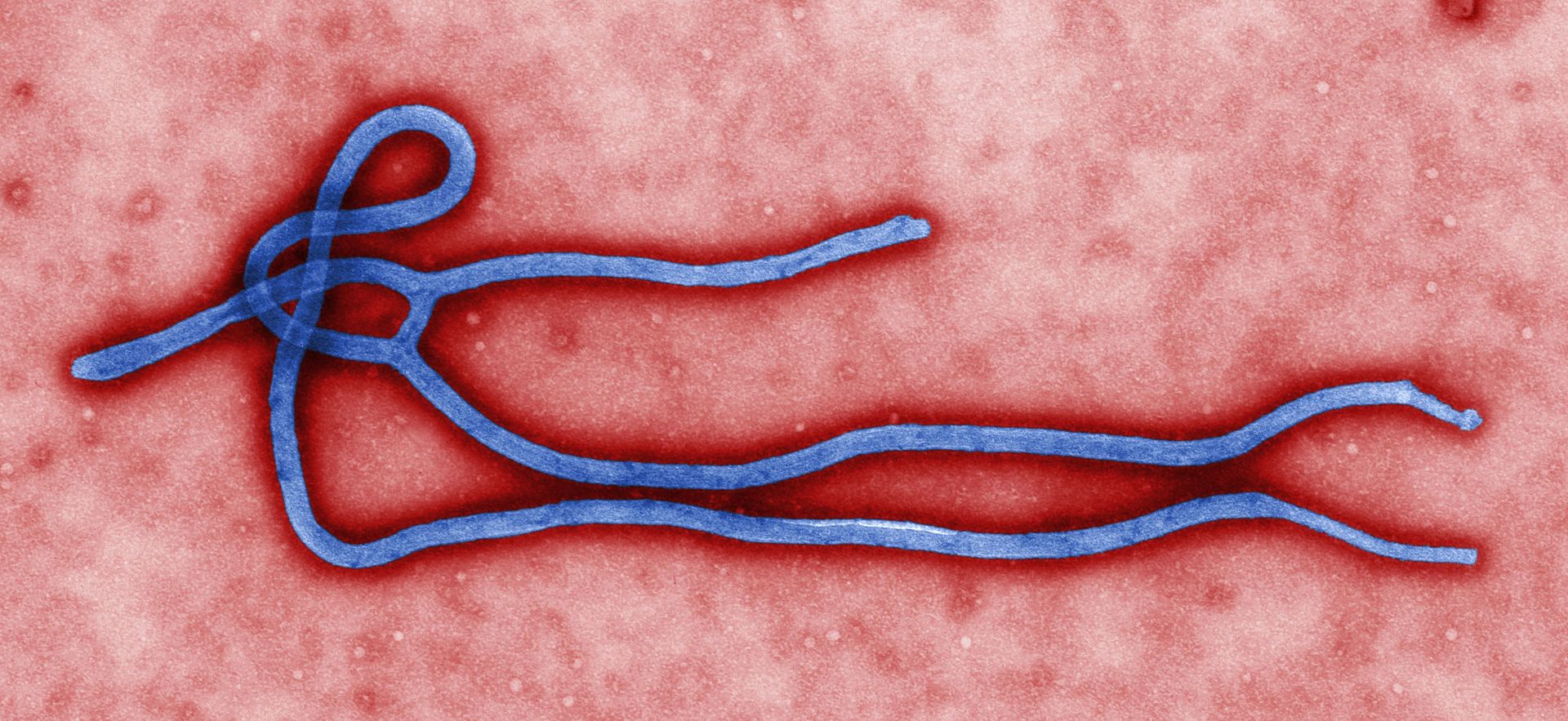 Вирус Эбола. Изображение © Wikimedia Commons / CDC / Cynthia Goldsmith 