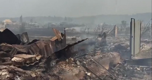 Из-за пожаров в Челябинской области за медпомощью обратились 18 человек