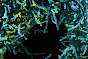 Российские учёные нашли убийц коронавируса в штамме лактобацилл