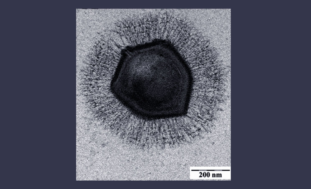 Мимивирус. Фото © Википедия