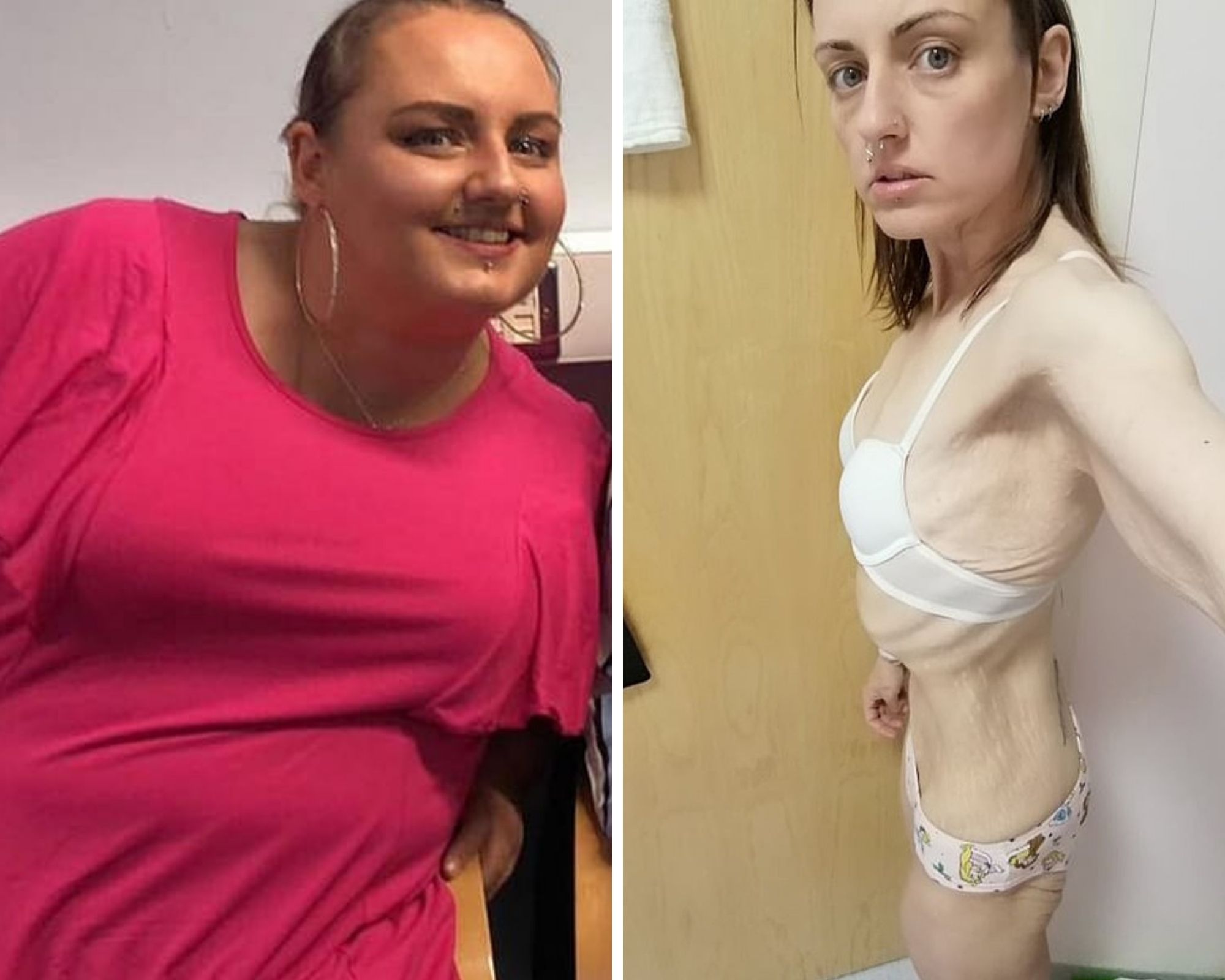 Натали до и после похудения. Фото © Caters News Agency