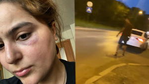 "Стало так больно": В Екатеринбурге таксист избил девушку после отказа платить больше установленной цены
