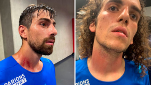 Появились фотографии повреждений игроков "Марселя" после драки с фанатами "Ниццы"