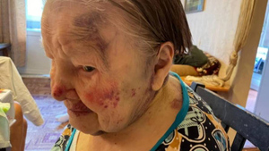 "У неё болит всё": В Екатеринбурге сиделку обвинили в жестоком избиении 95-летней бабушки