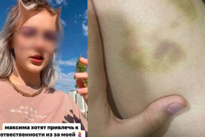 Школьница из Железногорска обвинила отца второго ребёнка в побоях, и теперь его разыскивает полиция
