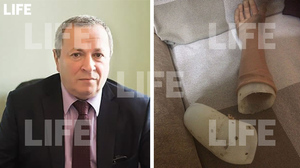 В Ленобласти наблюдатели сломали протез 60-летнему кандидату в депутаты