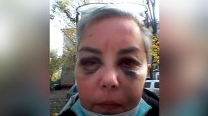 "Рёбра болели неделю": Дочь актёра Мерзликина избил бездомный, которому она помогла