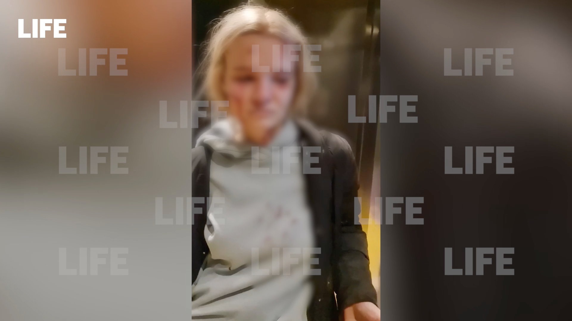 Жительница Красногорска вся в крови попала в больницу после поездки на взбесившемся лифте