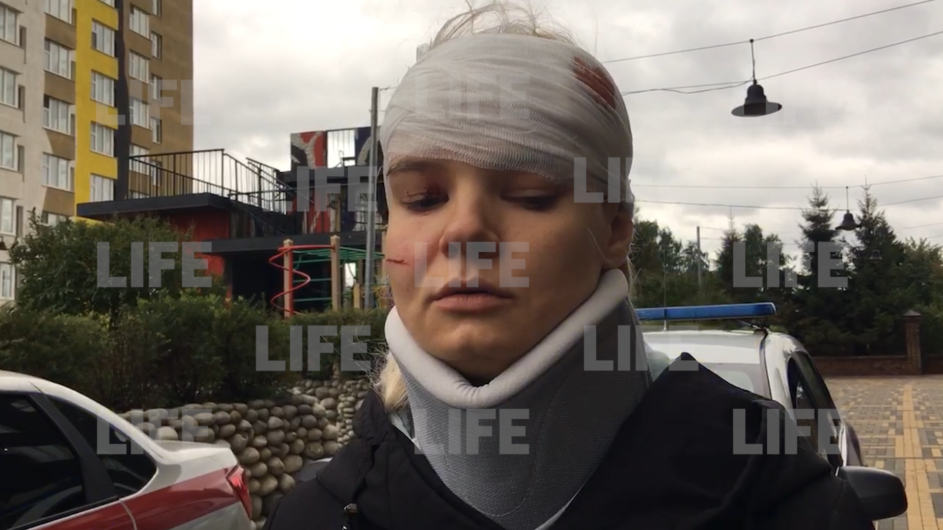 Травмированная при поездке во взбесившемся лифте жительница Красногорска сломала шею