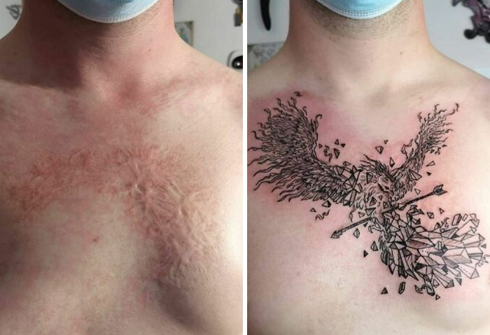 Спросите эксперта: может ли татуировка увеличить риск рака кожи?