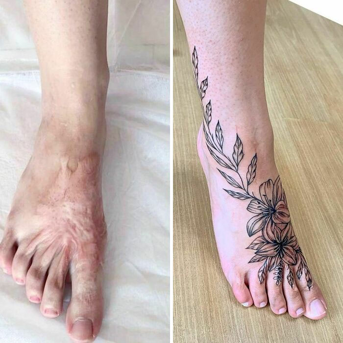 Могут ли татуировки вызывать рак