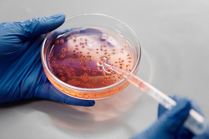 Учёные назвали устойчивость бактерий к антибиотикам основной причиной смертности в мире