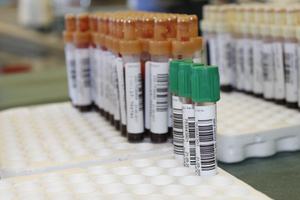 Профилактолог Токарев предупредил о сгущении крови после омикрон-штамма коронавируса