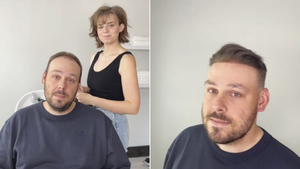 10 мужчинам подарили волосы, и эти преображения — причина не бояться облысения