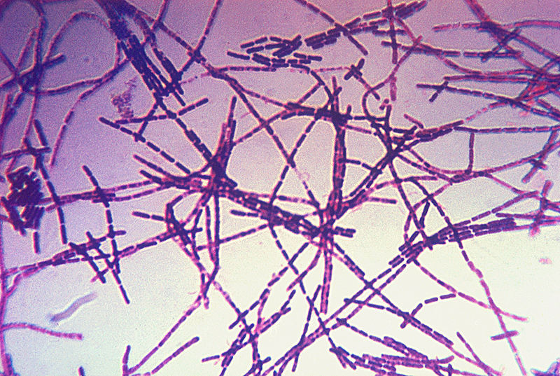 Микрофотография бактерий сибирской язвы. Фото © Wikipedia 