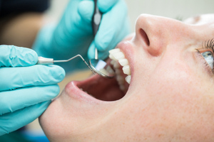 Стоматолог перечислила опасные способы домашнего отбеливания зубов