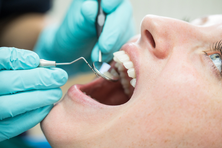 Стоматолог перечислила опасные способы домашнего отбеливания зубов