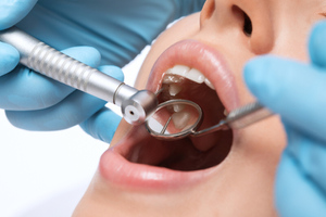 Стоматолог раскрыл зависимость потенции от состояния зубов