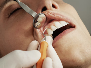 Стоматолог назвал болезни зубов, которые могут угробить весь организм