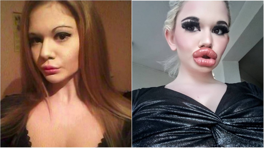 <p>Андреа Иванова до и после пластики. Фото © Instagram (запрещён на территории Российской Федерации) / Аndrea88476</p>
