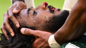 Защитнику Саудовской Аравии потребовалась операция после страшной травмы на поле