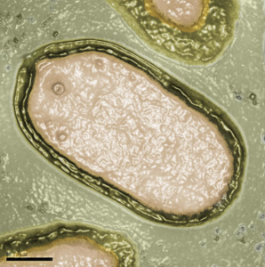 Pandoravirus. Фото © Wikipedia