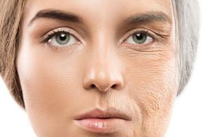 Названы три главные причины старения кожи