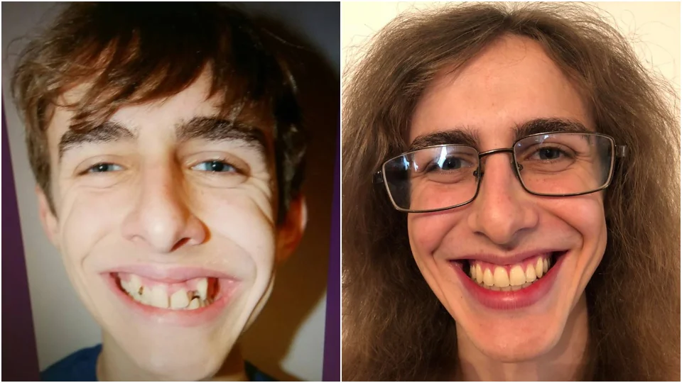 10 человек, которым всё-таки починили зубы, и только посмотрите на их счастливые улыбки